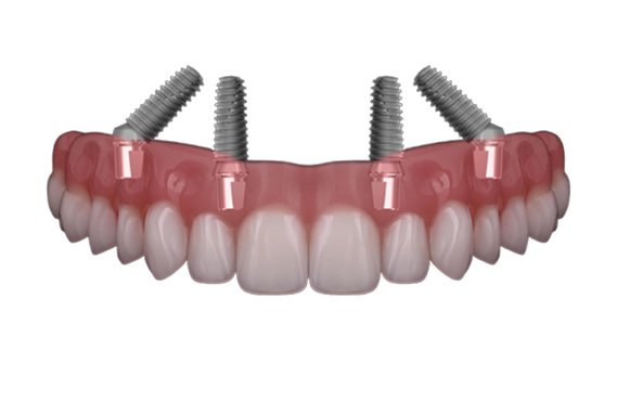 Teeth images